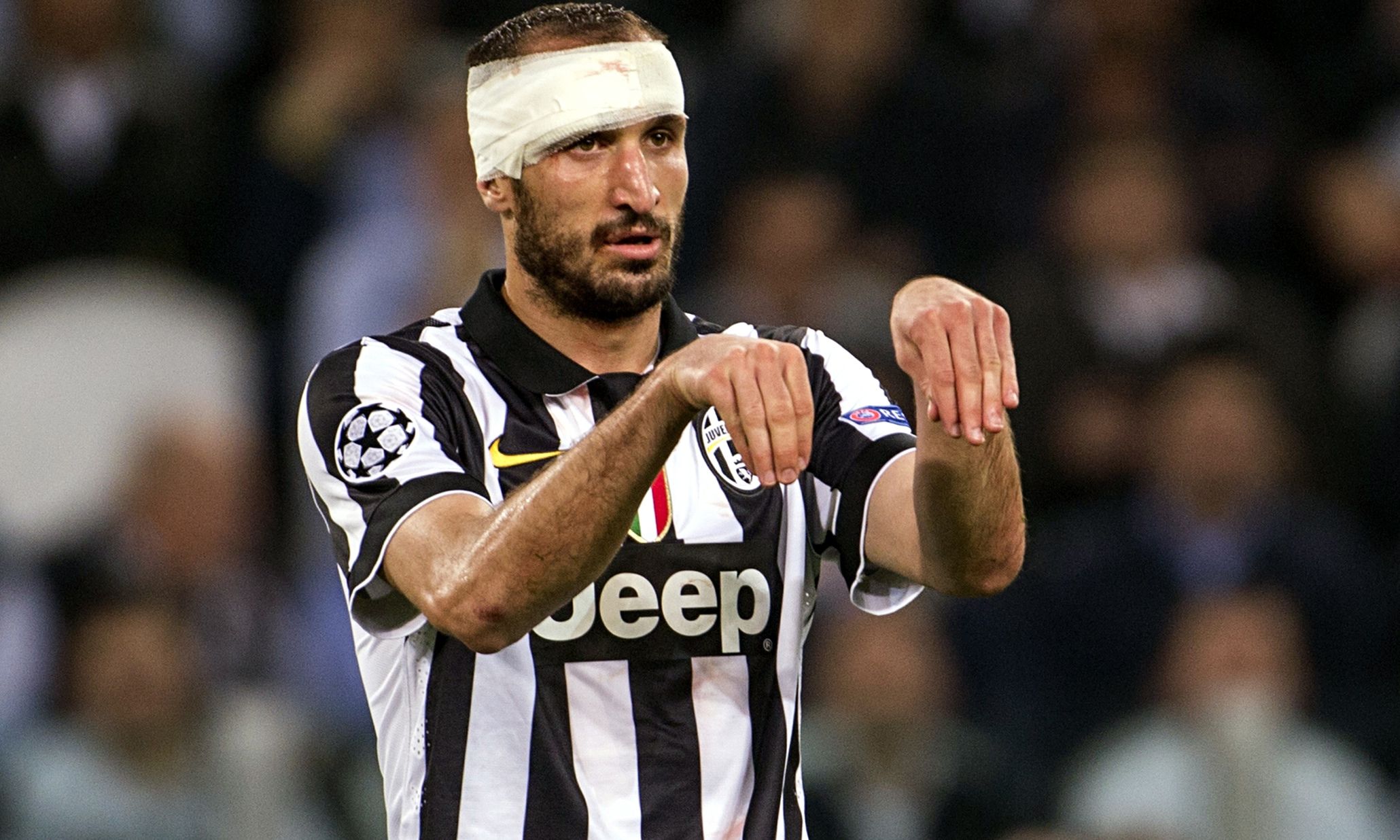 La Juve può diventare campione senza Chiellini in campo: punta alla Coppa Italia